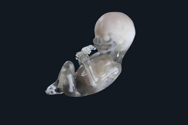 Surgical Fetus