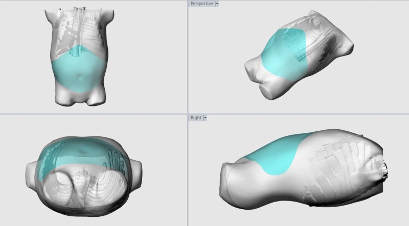 Neurovent Research